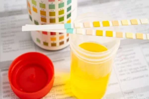 Urine : quand s'inquiéter de sa couleur ?